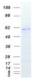 SDS-PAGE (XIAP-2775H).jpg